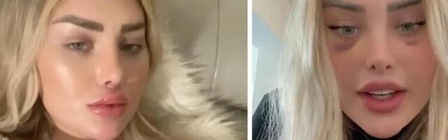 OnlyFans zvezdi eksplodirala glava u avionu