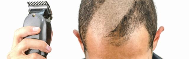 Da li bi muškarci trebalo da se šišaju na keca