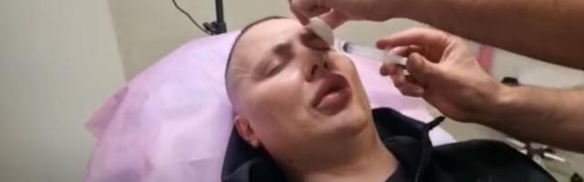 Bio najbolji frajer u rijalitiju, pa mu doktori unakazili lice: Izobličio se i naduo, pa nestao iz javnosti