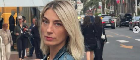 (FOTO) ANA STANIĆ SLOMILA NOGU: Pevačica se oglasila iz Francuske, štake u prvom planu