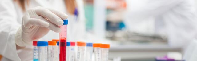 Preminula čuvena jugoslovenska naučnica: Nemerljiv doprinos mikrobiologiji