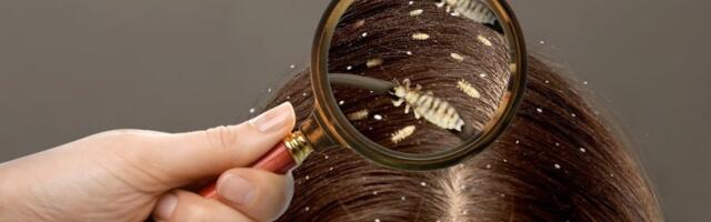 Sve što ste mislili da znate o vaškama - uglavnom nije tačno