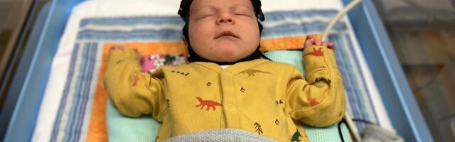 Revolucionarna kapa za mozak - nada za bebe rođene sa povredama