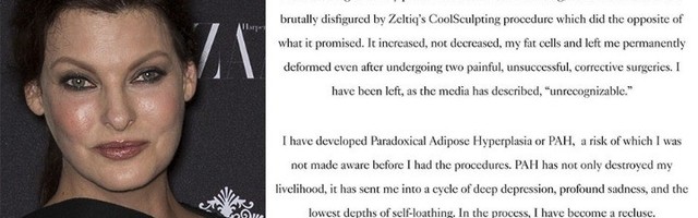 Progovorila Linda Evanđelista: Deformisana sam i umorna