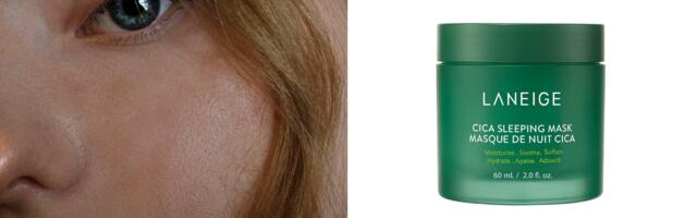 Ako imate rozaceu, ovih 5 proizvoda mogu pomoći sa simptomima crvenila