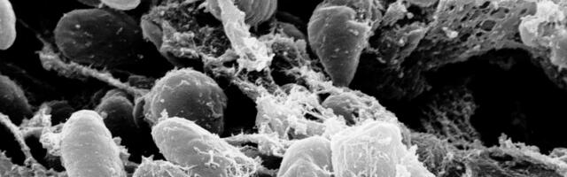 DNK studija otkriva nosioca najranije poznate kuge na svetu