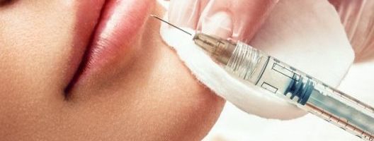 Odgovori na najčešća pitanja: Sve što treba da znate o botoksu