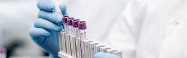 DRAMATIČNO Veliki skok zaraženih od korone