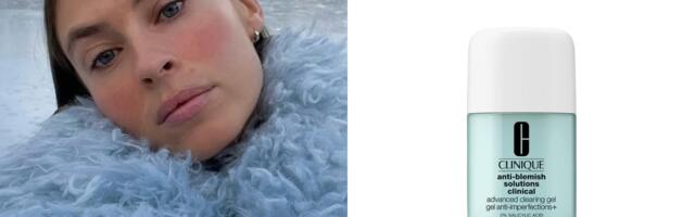 Za osetljivu kožu sklonu crvenilu, ovi anti-blemish preparati su must