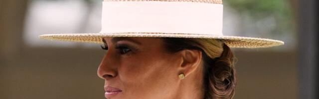 Šokantno lice Melanije Tramp: Svet bruji o novom izgledu - jagodice samo što ne eksplodiraju (FOTO)