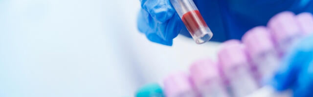 DECA NAJUGROŽENIJA, VIŠE OD 1.600 ZARAŽENIH! Opasan virus hara komšilukom, četvoro mrtvih!