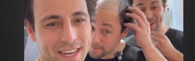 Braća otišla na transplataciju kose i evo kako izgledaju posle operacije: "Kada sam video "groblje" na svojoj glavi, morali smo da reagujemo!"