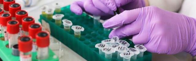 OPERACIJA SVE VIŠE, KRVI SVE MANJE! Dramatična situacija u Institutu za transfuziju! Građani, pomozite!