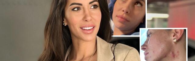 "Upala sam u kandže depresije" Cipka o paklu kroz koji je prošla posle smrti muža: "Ovo ne želim nikom!"