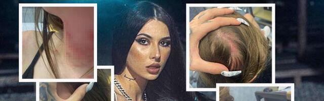 "Lobanja joj je izdeformisana, ne može da diše": Uki Q otkrila stanje pretučene sestre Sare