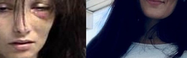 Devojčica se predozirala 19 puta, ali je uspela da pobedi zavisnost i ova promena koju je doživela je neverovatna