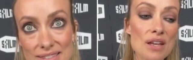 Olivija Vajld šokirala izgledom: Mršava, izbečena, sa ogromnim podočnjacima "Šta joj se dogodilo?"