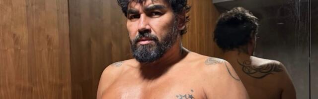 Azis pokazao nove grudi nakon ugradnje silikona! Stavili mu 600 kubika, puca od sreće: "Trenutno su otečene"