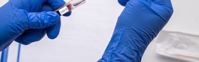 U Crnoj Gori još devet osoba umrlo od kovida