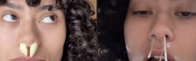 Doktor upozorava ljude da ne guraju beli luk u svoje nozdrve