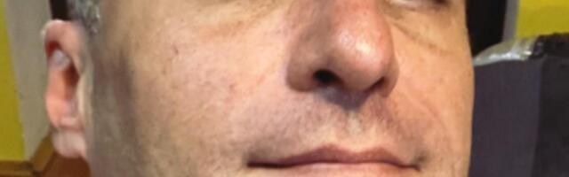 Političar koji je bio u rijalitiju VODI BITKU ZA ŽIVOT: Aleksandar progovorio o bolesti, pa otkrio kada je OPERACIJA