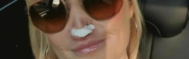 HOROR ISPLIVAO U JAVNOST! Majka dvoje dece (41) kod ZUBARA ostala bez DELA NOSA: Ni anestezija nije delovala, PAKAO