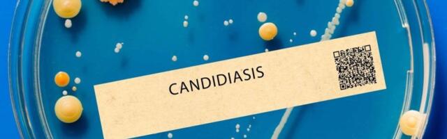 Imate li kandidu? Test sa čašom vode otkriva problem za samo 15 minuta