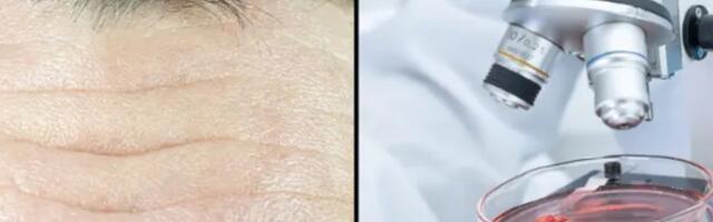 Istraživači uspešno preokrenuli starenje ćelija ljudske kože za 30 godina