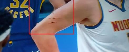 "MOLIMO VAS, ISECITE NOKTE ZBOG JOKIĆA" Jezivo - Srbinu zarili kandže u meso! Kao da je bio u kavezu sa divljim zverima, a ne na košarkaškom terenu!