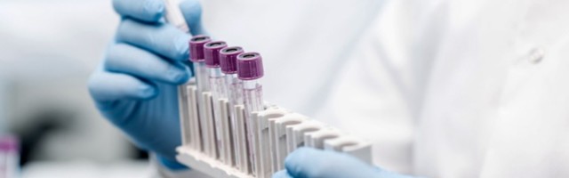 Preminuo još 21 pacijent, obolelo 2.813 osoba