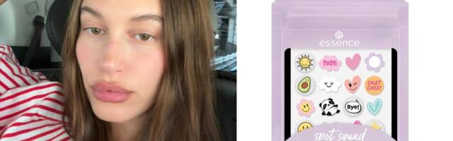 Flasteri za bubuljice (pimple patches) kao modni dodatak? Gen Z kaže: Što da ne!