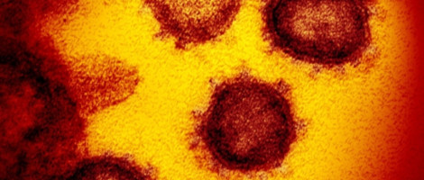 Na nekim površinama korona virus preživljava i do 28 dana