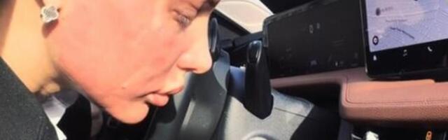 UNIŠTENO LICE VODITELJKE PINKA! Ožijci joj izmenili LIČNI OPIS, prizor će vas UZNEMIRITI - SAD JE NEPREPOZNATLJIVA