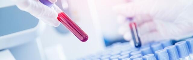 Novi test krvi mogao bi da predvidi bolesti i do 10 godina unapred