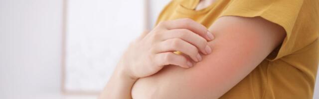 BEOGRAĐANI SE ŽALE NA POJAVU NEOBIČNU ZA KRAJ NOVEMBRA! Ujutru sam ustala, bacim pogled, imam šta i da vidim - tri pečata