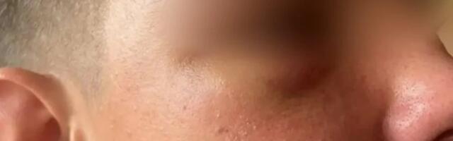 Otac dječaka pretučenog u Novom Pazaru: Policija ima snimke, srušili su ga na pod, a zatim šutirali nogama