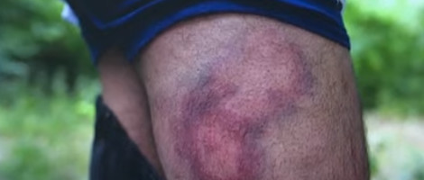 Vijeće Evrope poziva Hrvatsku da zaustavi nasilje nad migrantima