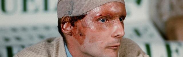 SVEŠTENIK MU OČITAO OPELO NAKON ŠTO JE ŽIV GOREO, A ON SE "VRATIO IZ MRTVIH"! Krv mu bila zatrovana, a on je postao čudo nad čudima!