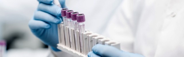 STRAŠNO U Italiji još 853 osobe umrle od kovida