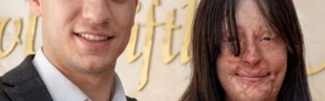 Bivši joj bacio kiselinu u lice, a ona se ipak udala za njega: Sve uradila u tajnosti, otac poludeo kad je čuo