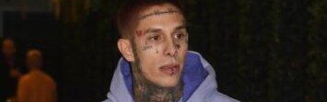 PROLIVENA KRV PO TELU!! Fran Pujas napravio HAOS novom objavom, evo šta kaže nakon POMETNJE! (FOTO)