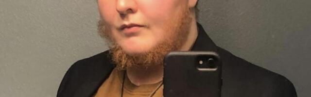 Od detinjstva mi raste brada iako sam žena: Najgnusnije su me vređali, a sada je moj život potpuno drugačiji
