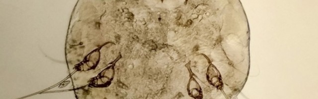 Nikada niste sami sa grinjama, sićušnim paučnjacima koji žive u vašim porama!