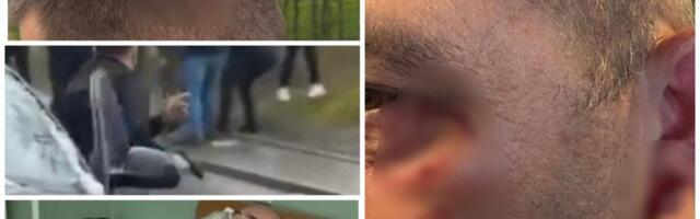 Batinaška politika blokadera! Napadaju žene, biju, potežu pištolje: Pala krv u Bajinoj Bašti, Smederevskoj Palanci... (FOTO/VIDEO)