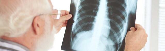 U Zrenjaninu se obavlja besplatan skrining za rano otkrivanje raka pluća