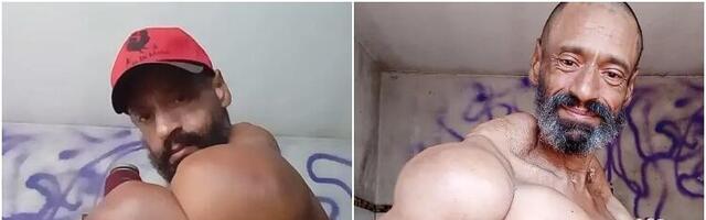 Brazilac ne želi da odustane od opasnog pumpanja mišića uprkos upozorenjima lekara