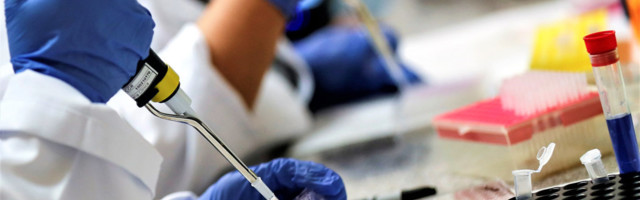 U planu opremanje laboratorije za analizu PCR testova u Čačku