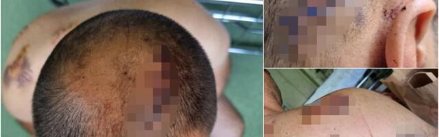 UBOLA MUŽA NA SPAVANJU 17 PUTA, VEŠTAK KAŽE DA JE POSTALA NEURAČUNLJIVA POSLE 13. UBODA?! Advokat oštećenog muškaraca iz Jagodine: Ovde je pripremana zavera