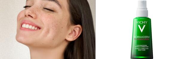 Zašto masnoj koži treba gel, a ne bogata krema?