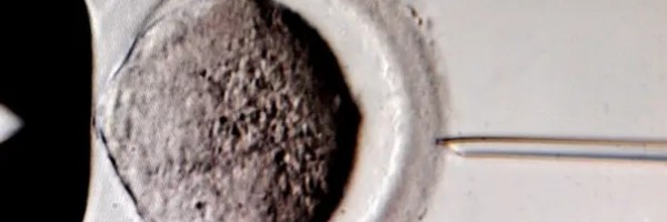 Doktor optužen za začeća njegovom spermom prihvata sudsku nagodbu